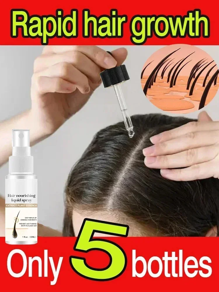 Hair Growth Products Fast Growing Essential Oil Biotin Prevent Loss Serum Spray Scalp Treatment Beauty Care For Men Women 1
