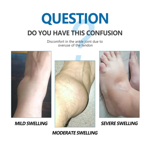 Ankle Joint Care Essential Oil Relieves Foot Ankle Joint Stiffness and Soreness Massage Care Serum Oil Personal Health Care 2